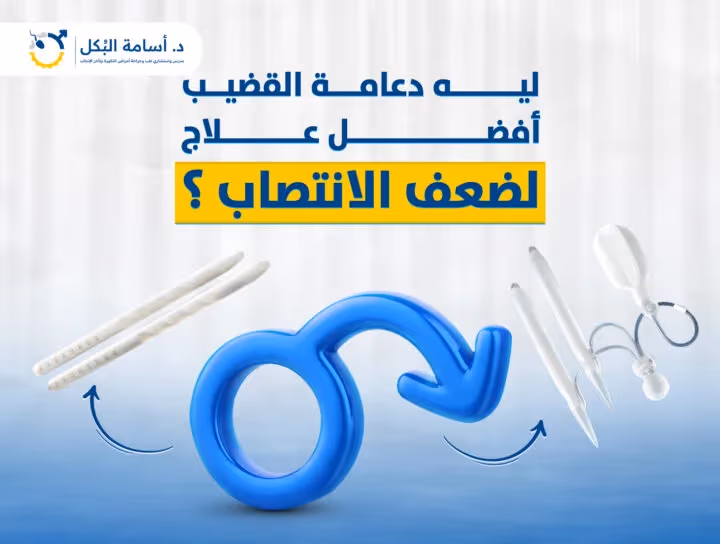 صورة توضيحية لعلاج ضعف الانتصاب وتركيب دعامات القضيب